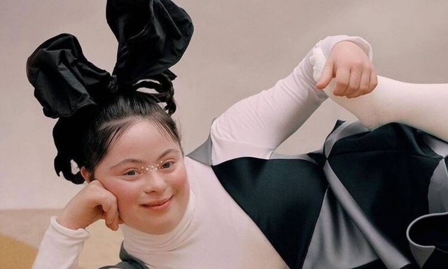 Το 18χρονο μοντέλο με σύνδρομο Down που κατέρριψε κάθε εμπόδιο