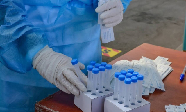 Κορονοϊός: Ασύλληπτο λάθος στο Κιλκίς - Εντοπίστηκαν 102 θετικά κρούσματα από... λάθος!