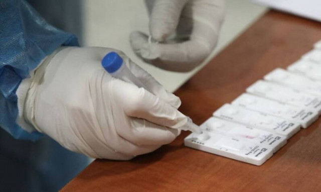 Κρούσματα σήμερα: Στα ύψη η αγωνία λόγω των πολλών διασωληνωμένων - Πού θα γίνουν νέοι έλεγχοι