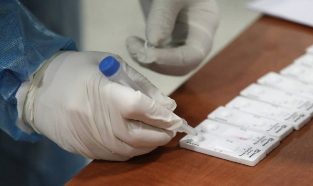 Koρονοϊός: Δέκα φορές πάνω τα κρούσματα στη δυτική Αττική από άλλες περιοχές της Αθήνας