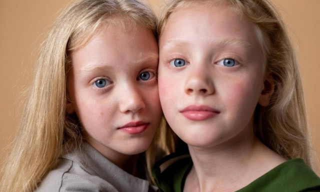 10+1 περίεργα facts για τα δίδυμα που θα σας εκπλήξουν