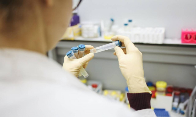 Αντιπεριφερειάρχης στον Alpha 98,9: Είχα ενημερώσει για την κατάσταση στην Δ. Αττική τον ΕΟΔΥ