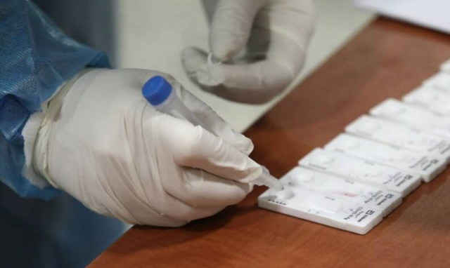 Κρούσματα σήμερα: Στο «κόκκινο» η αγωνία για τις μολύνσεις λίγο πριν τα Χριστούγεννα