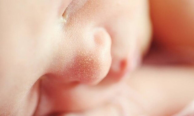 Θεσσαλονίκη: Αίσιo τέλος για το μωράκι που κατάπιε χάντρα