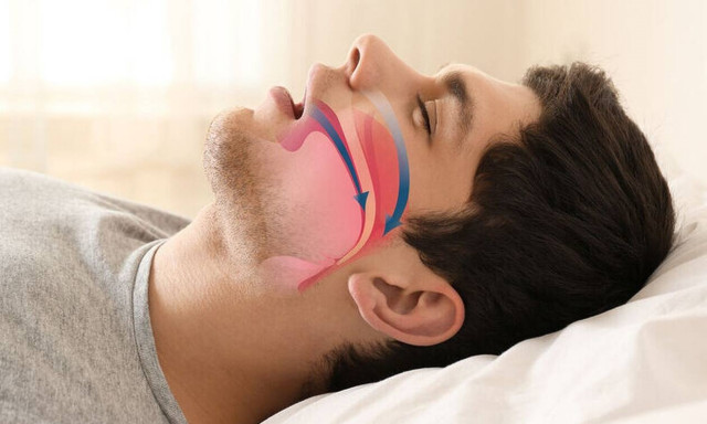 Ξεχνάω... Μήπως πάσχω από Yπνική Άπνοια;