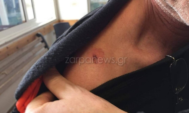 Απίστευτο: Ασυνείδητος πυροβολεί εργαζομένους καθαριότητας -Νεαρός τραυματίστηκε στον ώμο από σφαίρα