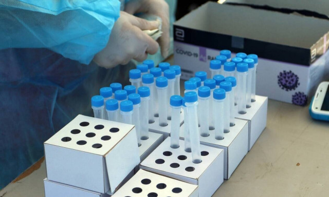 Περιφέρεια Αττικής: Ανυπόστατοι και συκοφαντικοί οι ισχυρισμοί για το κόστος των rapid test