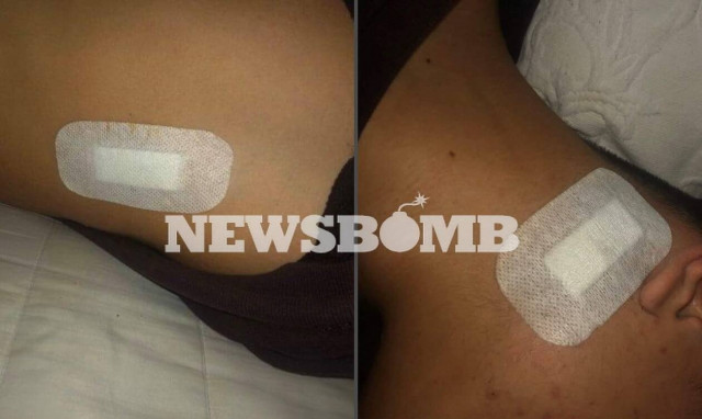 Φώτο-ντοκουμέντο: Μαχαιριά σε ανήλικο δίπλα στην καρωτίδα- Η ΕΛ.ΑΣ. ψάχνει την «ομάδα της Τερψιθέας»