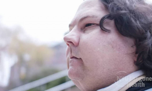 ΗΠΑ: Η πρώτη επιτυχημένη τριπλή μεταμόσχευση προσώπου και χεριών παγκοσμίως