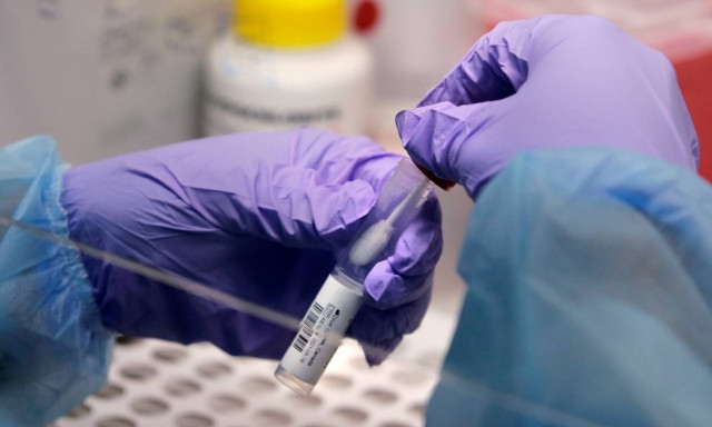 Κορονοϊός: Μεταλλαγμένα στελέχη – Πόσο ανθεκτικά είναι στα «κοκτέιλ» αντισωμάτων