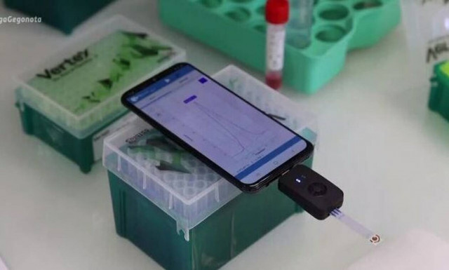 Γαλλία: Επιστήμονες ετοιμάζουν κινητό που θα κάνει τεστ κορονοϊού (video)