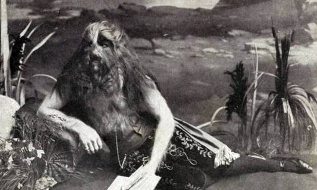 Top10: Οι δέκα πιο σπάνιες και παράξενες ασθένειες στην ιστορία της ανθρωπότητας