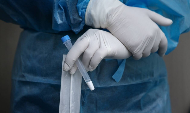 Κορονοίός - Παρασκευής: Αυτή την εβδομάδα ίσως έρθουμε αντιμέτωποι με την κορύφωση του κύματος