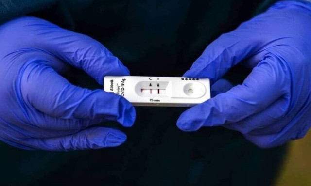 Κορονοϊός: Ποιοι εργαζόμενοι είναι υποχρεωμένοι να κάνουν self test