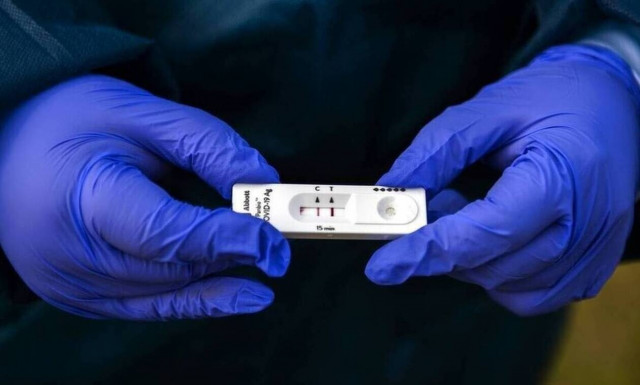 Self Test: Αγώνας δρόμου για να φτάσουν τα πρώτα 2 εκατ. - Σήμερα οι ανακοινώσεις