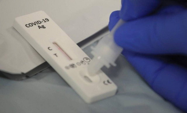 Κορονοϊός: Πώς γίνεται η αυτοαπομόνωση στο σπίτι - Τα βήματα μετά από θετικό self test