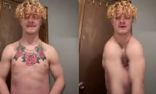 Πάσχει από μια σπάνια πάθηση και χτυπά παλαμάκια με τους ώμους