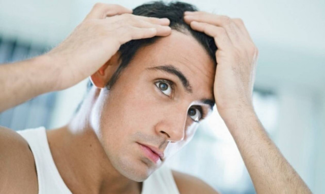 Τι μπορείς να κάνεις για την τριχόπτωση