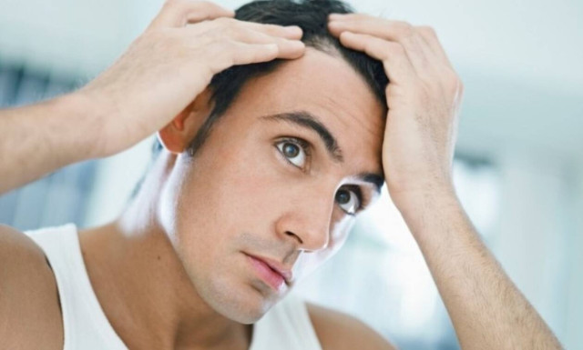 Τι μπορείς να κάνεις για την τριχόπτωση