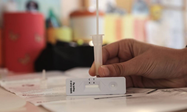 Πελώνη για self test: Δεν υπάρχει πιθανότητα κάποιος με αρνητικό test να διαγνωσθεί θετικός