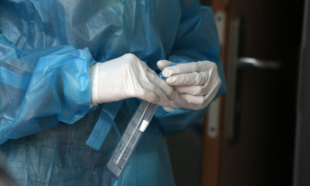 Βατόπουλος: Μη βιαζόμαστε να πετάξουμε τη μάσκα, είναι χρήσιμη - Πότε θα χτιστεί τείχος ανοσίας