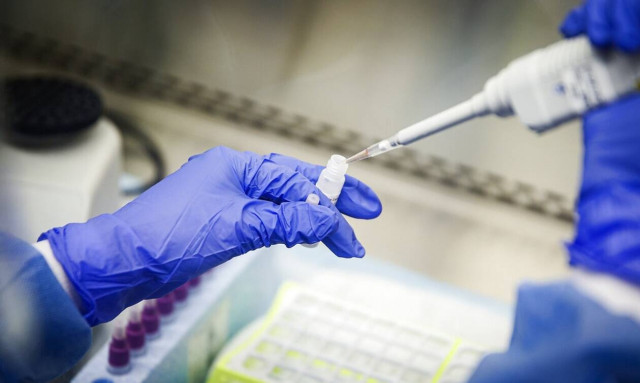 Κορονοϊός: Η προηγούμενη λοίμωξη Covid-19 μειώνει έως για 10 μήνες τον κίνδυνο νέας μόλυνσης