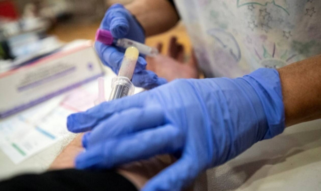 Συνδυασμός μονοκλωνικών αντισωμάτων κατά του κορονοϊού – Πότε μειώνει τον κίνδυνο θανάτου