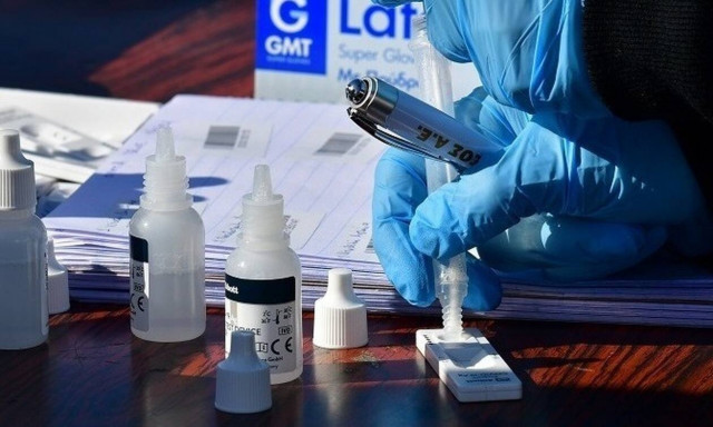 Αυξημένη η προσέλευση κόσμου για rapid test στους δήμους των νοτίων προαστίων της Αττικής