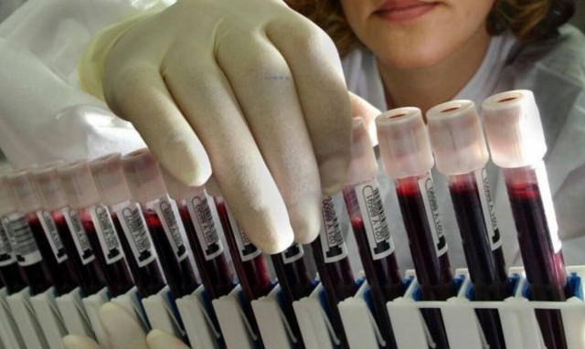 Κορονοϊός: Τεστ δείχνει αν έχουμε πιθανότητες να κολλήσουμε τον ιό και πόσο σοβαρά