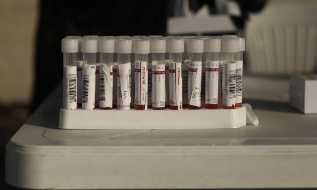 Τεστ αντισωμάτων: Γιατί δεν χρησιμοποιούνται ως αποδεικτικό ανάγκης για τρίτη δόση εμβολίου