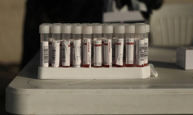 Αναπτύχθηκε φθηνό φορητό τεστ αντισωμάτων Covid-19 που βγάζει αποτέλεσμα μόνο σε πέντε λεπτά