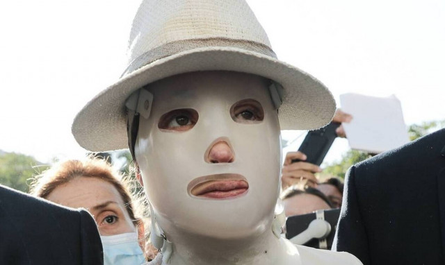 Επίθεση με βιτριόλι: «Θα αποκαλυφθεί ποια είναι η αλήθεια» λέει ο δικηγόρος του 40χρονου