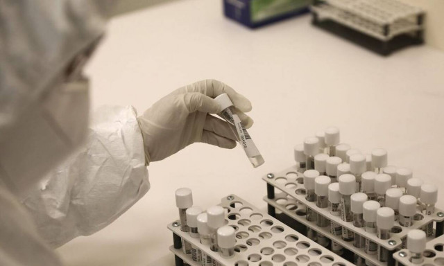 Κορονοϊός - Τζανάκης: «Τα αντισώματα και οι εξετάσεις δεν ανιχνεύουν την πραγματική ανοσία»