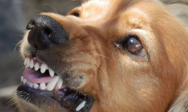 Επίθεση σκύλου Θεσσαλονίκη