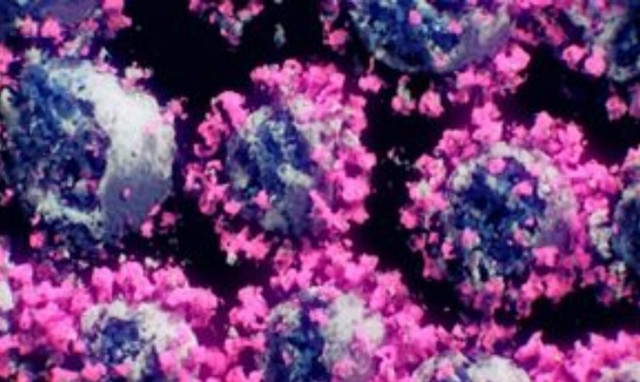 Πόσο κρατάει η ανοσία μετά τον εμβολιασμό για την COVID19 - Πόσο σημαντική είναι η μείωσή της