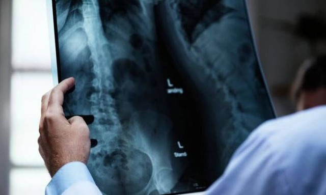 Καρκίνος του μαστού: Δεν είναι μόνο γυναικεία υπόθεση - Άνδρας που νόσησε εξομολογείται στο Newsbomb