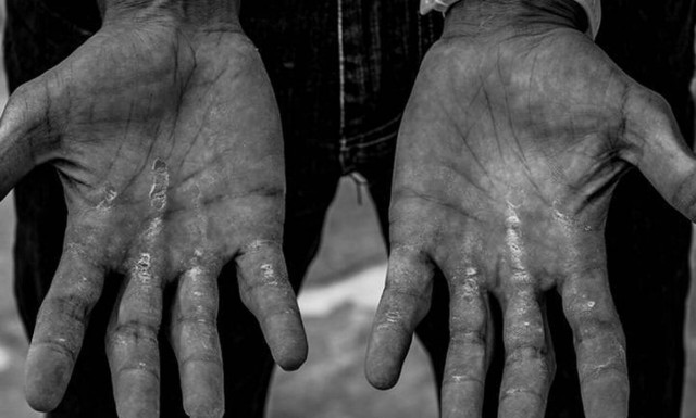 «Behind The Flame» - Η επιτυχημένη έκθεση του Νίκου Ζήκου, παίρνει παράταση έως τις 18/10