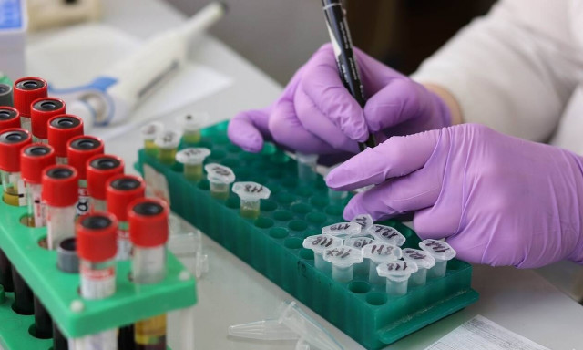 Αναστολή της απεργίας στις 12 Οκτωβρίου αποφάσισαν οι ιδιωτικές μονάδες Πρωτοβάθμιας Υγείας