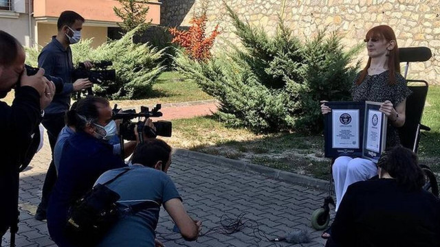 Η ψηλότερη γυναίκα στον κόσμο ζει στην Τουρκία και αισθάνεται άνετα με τα 215 εκατοστά της (video)