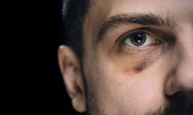 Ο διάσημος που έριχνε γροθιές όταν του ζητούσαν αυτόγραφο!