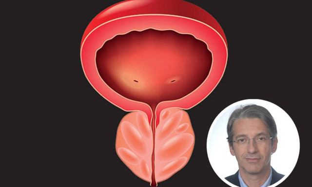 HoLEP: Η νέα ιατρική και ασφαλή πρωτοπορία στην αντιμετώπιση της υπερπλασίας προστάτη