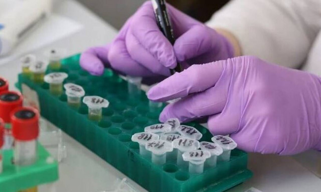 Μονοκλωνικά αντισώματα