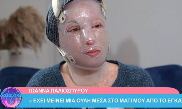 Η Ιωάννα έδειξε για πρώτη φορά τα εγκαύματά της και τα ρούχα που φόραγε την ημέρα της επίθεσης