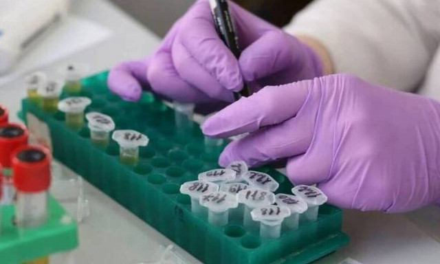 Μονοκλωνικά αντισώματα: Διεύρυνση κριτηρίων για τη χορήγησή τους ανακοίνωσε η Μίνα Γκάγκα