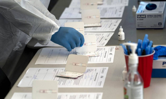Μετάλλαξη Όμικρον: Το rapid test με δείγμα από τη μύτη ίσως δεν ανιχνεύει γρήγορα τον ιό