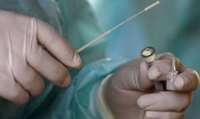 Κορονοϊός - Βραζιλία: 251 θάνατοι και 112.286 νέα κρούσματα τις προηγούμενες 24 ώρες