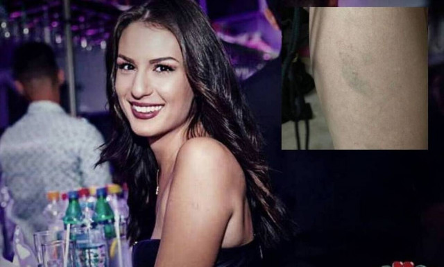 Βιασμός στη Θεσσαλονίκη: Στο μικροσκόπιο το δεύτερο πρόσωπο – Παρασκευή η νέα κατάθεση της 24χρονης