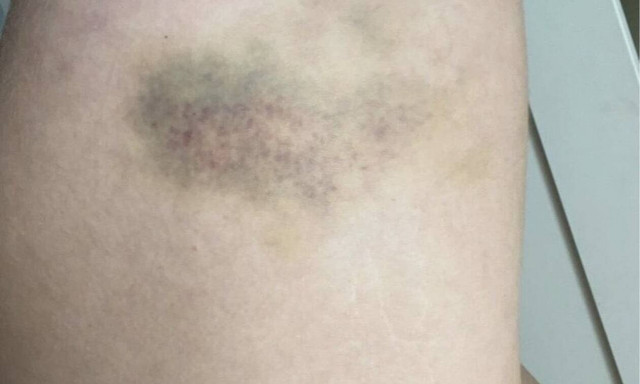 Σάλος με Μέισον Γκρίνγουντ - Κατηγορείται για τον ξυλοδαρμό της συντρόφου του (photos)