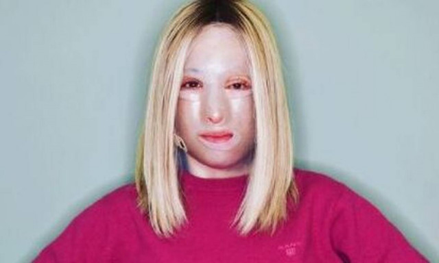 Ιωάννα Παλιοσπύρου: Η πρώτη φωτογραφία μετά το νέο χειρουργείο που υποβλήθηκε