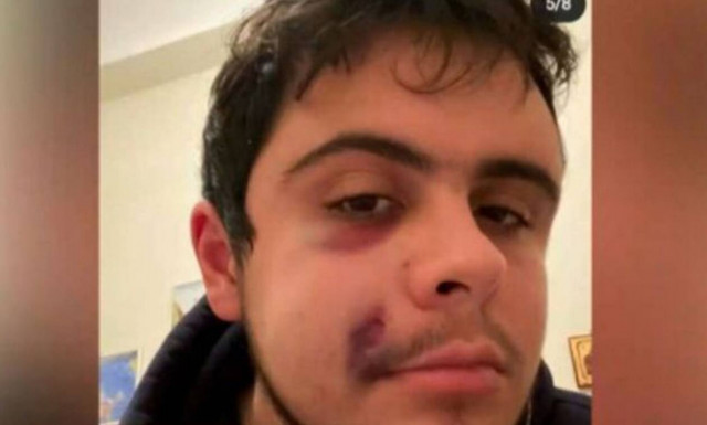 Κρήτη: «Με χτυπούσαν πεσμένο στο κεφάλι χωρίς οίκτο» – 23χρονος καταγγέλλει οπαδική βία